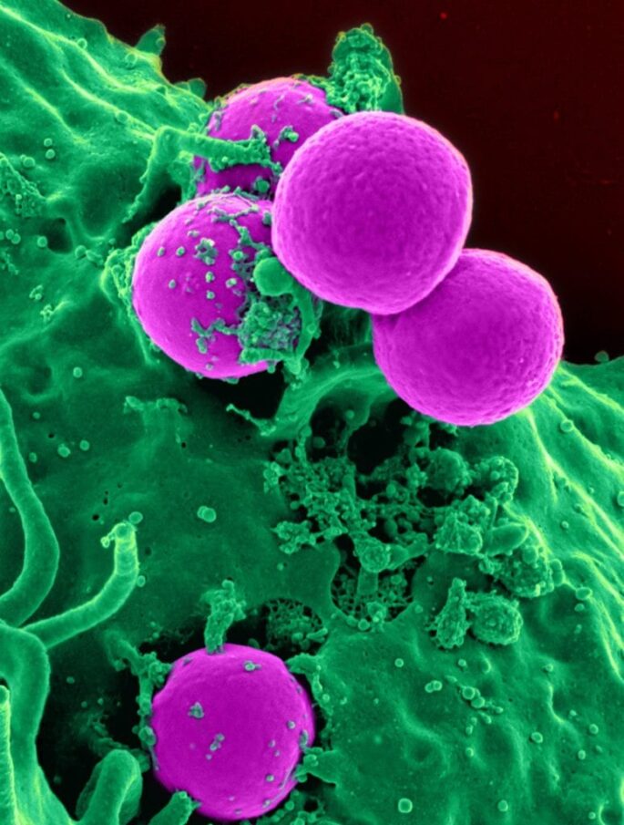 purple microbes on a green organism
