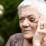 an older woman with a black eye